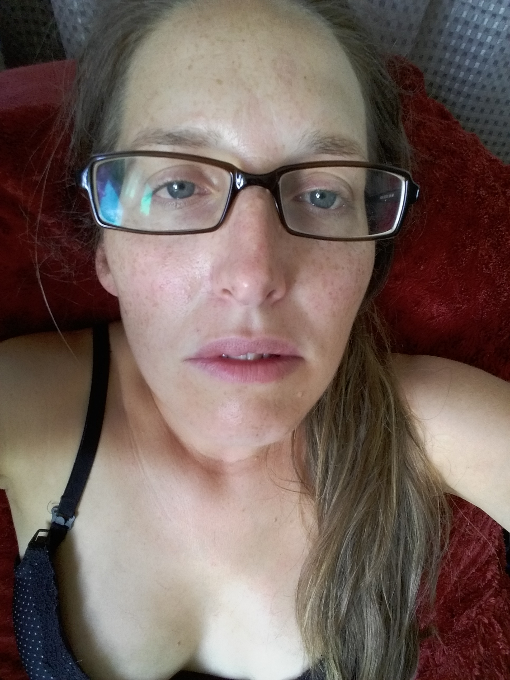 A Pain in the Arse. Part 3: Breastfeeding & Surgery.