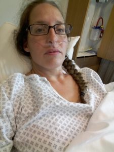 After surgery